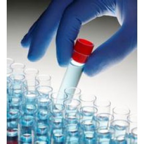 膜鐵轉運蛋白(FPN)多克隆抗體(Mouse_上海鈺博生物科技